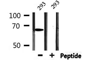 Western blot analysis of extracts from 293, using PIAS2 Antibody. (PIAS2 Antikörper)