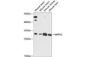 Western blot analysis of extracts of various cell lines using MRPS2 Polyclonal Antibody at dilution of 1:3000. (MRPS2 Antikörper)