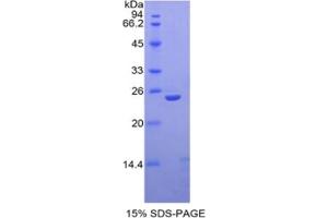 SDS-PAGE of Protein Standard from the Kit (Highly purified E. (Thrombospondin 1 ELISA Kit)