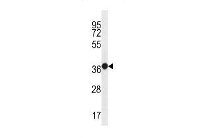 Western blot analysis in WiDr cell line lysates (35ug/lane). (MUC15 Antikörper  (C-Term))