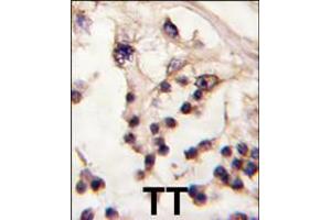Formalin-fixed and paraffin-embedded human testis tissue reacted with TESK2 antibody , which was peroxidase-conjugated to the secondary antibody, followed by DAB staining. (TESK2 Antikörper  (AA 210-240))
