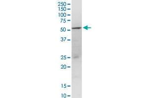 Western Blotting (WB) image for anti-Glutamic-Oxaloacetic Transaminase 1, Soluble (Aspartate Aminotransferase 1) (GOT1) (AA 1-413) antibody (ABIN516133)