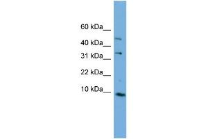 WB Suggested Anti-C16orf61 Antibody Titration: 0.