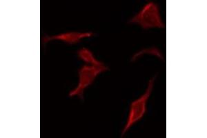 Immunofluorescence (fixed cells) (IF/ICC) image for anti-Caspase 3 (CASP3) (Internal Region) antibody (ABIN6260481)