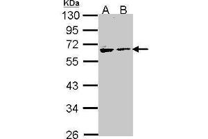 WB Image Sample (30 ug of whole cell lysate) A: H1299 B: Hela 10% SDS PAGE antibody diluted at 1:1000 (Arylsulfatase A Antikörper)