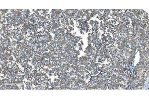 IHC analysis of DRP1/DNM1L using anti-DRP1/DNM1L antibody (ABIN7602180). (Dynamin 1-Like Antikörper  (AA 618-736))