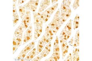 Immunohistochemistry analysis of paraffin-embedded rat muscle using,MYH7 (ABIN7075623) at dilution of 1: 1000 (Slow Skeletal Myosin Heavy Chain Antikörper)