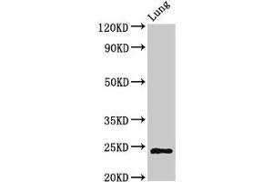 Western Blot Positive WB detected in: Rat lung tissue All lanes: CHMP6 antibody at 3 μg/mL Secondary Goat polyclonal to rabbit IgG at 1/50000 dilution Predicted band size: 24 kDa Observed band size: 24 kDa (CHMP6 Antikörper  (AA 2-201))