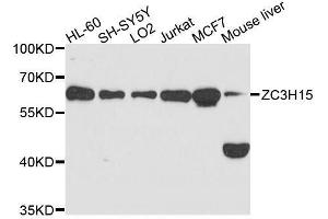 Western blot analysis of extracts of various cell lines, using ZC3H15 antibody. (ZC3H15 Antikörper  (AA 1-300))