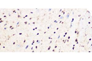 Immunohistochemistry of paraffin-embedded Mouse spinal cord using PCIF1 Polyclonal Antibody at dilution of 1:100 40x lens).