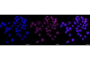 Immunocytochemical staining of HAP-1 cells with NK2 homeobox 2 antibody (ABIN7799610), 1:1,000). (Rekombinanter Nkx2-2 Antikörper)