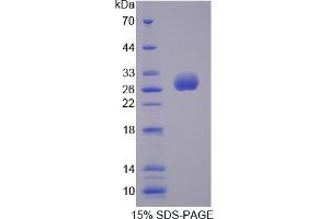 Image no. 1 for UL16 Binding Protein 2 (ULBP2) (AA 2-246) protein (His tag) (ABIN3209971) (ULBP2 Protein (AA 2-246) (His tag))