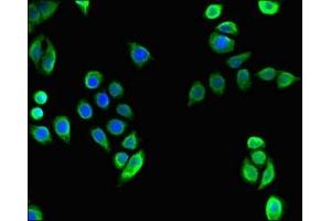 Immunofluorescent analysis of PC-3 cells using ABIN7171684 at dilution of 1:100 and Alexa Fluor 488-congugated AffiniPure Goat Anti-Rabbit IgG(H+L) (TECPR2 Antikörper  (AA 516-783))