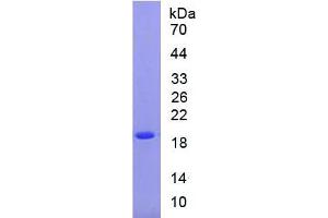 SDS-PAGE of Protein Standard from the Kit (Highly purified E. (SOD1 ELISA Kit)