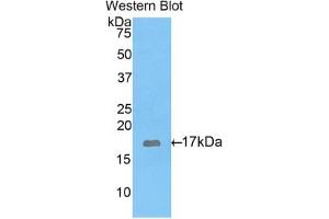 Detection of recombinant GAD1 using Polyclonal Antibody to Glutamate Decarboxylase 1, Brain (GAD1) (GAD Antikörper  (AA 1-97))