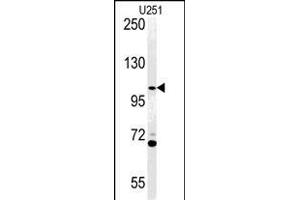Acap3 Antikörper  (N-Term)