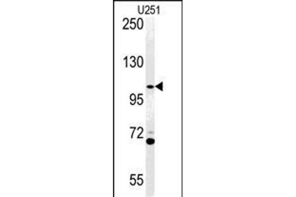 Acap3 Antikörper  (N-Term)