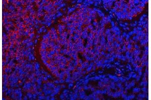 IF analysis of TRMT2B using anti-TRMT2B antibody (ABIN7599456). (TRMT2B Antikörper  (AA 1-504))
