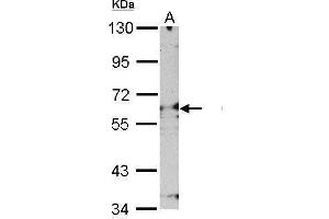 WB Image Sample (30 ug of whole cell lysate) A: NIH-3T3 7. (Proteasome 26S S3 (Center) Antikörper)