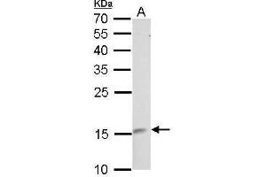 WB Image LMO1 antibody detects LMO1 protein by Western blot analysis. (LMO1 Antikörper)