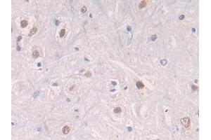 Detection of CTSG in Rat Spinal cord Tissue using Polyclonal Antibody to Cathepsin G (CTSG) (Cathepsin G Antikörper  (AA 51-250))