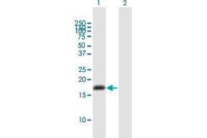 Western Blot analysis of CYP2U1 expression in transfected 293T cell line by CYP2U1 MaxPab polyclonal antibody. (CYP2U1 Antikörper  (AA 1-168))