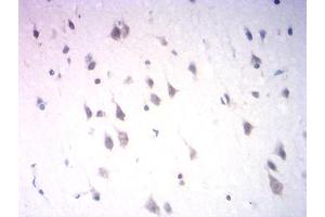 Immunohistochemistry (IHC) image for anti-Neuronal Differentiation 1 (NEUROD1) (AA 26-91) antibody (ABIN7193474)