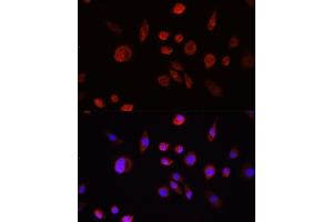 Immunohistochemistry of paraffin-embedded rat lung using  Rabbit pAb (ABIN6133551, ABIN6136733, ABIN6136738 and ABIN6215039) at dilution of 1:150 (40x lens). (AKT1 Antikörper  (C-Term))