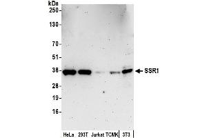 Western Blotting (WB) image for anti-Signal Sequence Receptor, alpha (SSR1) (AA 236-286) antibody (ABIN7452977)