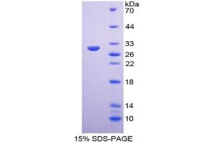 Image no. 1 for Arginyl Aminopeptidase (Aminopeptidase B) (RNPEP) (AA 388-616) protein (His tag) (ABIN6237928)