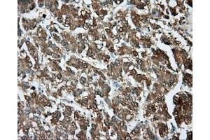 Immunohistochemical staining of paraffin-embedded pancreas tissue using anti-PIM2 mouse monoclonal antibody. (TPMT Antikörper)