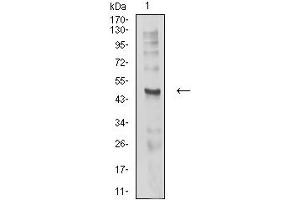 Western Blotting (WB) image for anti-Cholinergic Receptor, Nicotinic, delta (Muscle) (CHRND) (AA 22-245) antibody (ABIN5611361)