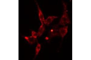 ABIN6274589 staining Hela cells by IF/ICC. (ARRDC3 Antikörper  (C-Term))