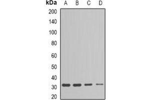 Western blot analysis of ESD expression in Jurkat (A), HepG2 (B), mouse liver (C), mouse kidney (D) whole cell lysates. (Esterase D Antikörper)