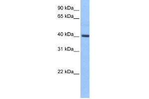 WB Suggested Anti-PDXK Antibody Titration: 0. (PDXK Antikörper  (Middle Region))