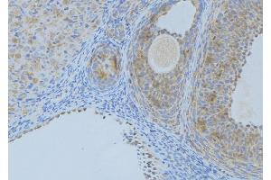 ABIN6276407 at 1/100 staining Human uterus tissue by IHC-P. (Angiopoietin 2 Antikörper  (N-Term))