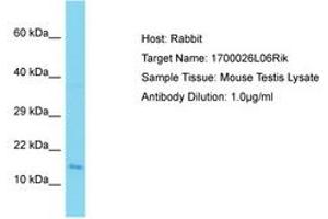 Image no. 1 for anti-Chromosome 9 Open Reading Frame 9 (C9ORF9) (AA 92-141) antibody (ABIN6750340) (C9orf9 Antikörper  (AA 92-141))