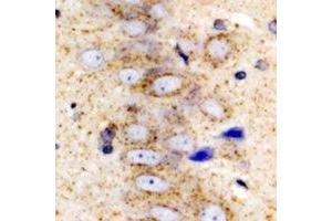 Immunohistochemistry (IHC) image for anti-serpin Peptidase Inhibitor, Clade A (Alpha-1 Antiproteinase, Antitrypsin), Member 10 (SERPINA10) antibody (ABIN7308316)