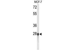 Western blot analysis of ABHDB Antibody (Center) in MCF-7 cell line lysates (35 µg/lane). (ABHD11 Antikörper  (Middle Region))
