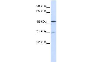 WB Suggested Anti-TMPRSS11D Antibody Titration:  1 ug/ml  Positive Control:  293T cells lysate (TMPRSS11D Antikörper  (Middle Region))