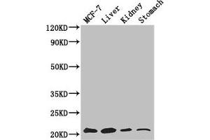 Western Blot Positive WB detected in: MCF-7 whole cell lysate, Mouse liver tissue, Mouse kidney tissue, Mouse stomach tissue All lanes: GNPNAT1 antibody at 3. (GNPNAT1 Antikörper  (AA 1-184))