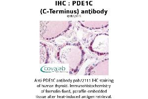 Image no. 1 for anti-phosphodiesterase 1C, Calmodulin-Dependent 70kDa (PDE1C) (C-Term) antibody (ABIN1737910) (PDE1C Antikörper  (C-Term))