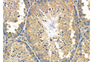ABIN6264077 and ABIN6278944 at 1/100 staining Mouse testis tissue by IHC-P. (PDCD2L Antikörper  (Internal Region))