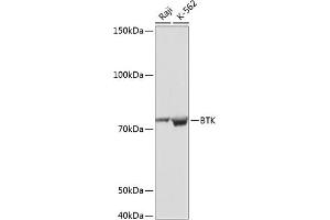 Western blot analysis of extracts of various cell lines, using BTK antibody (ABIN7265950) at 1:1000 dilution. (BTK Antikörper)