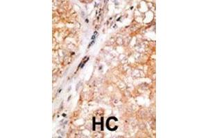 Immunohistochemistry (Paraffin-embedded Sections) (IHC (p)) image for anti-BCL2-Like 2 (BCL2L2) (AA 24-59) antibody (ABIN388097)