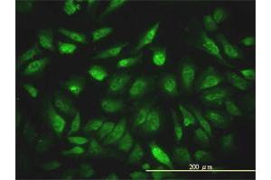 Immunofluorescence of monoclonal antibody to NCOA4 on HeLa cell. (NCOA4 Antikörper  (AA 1-575))