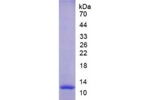 SDS-PAGE analysis of Rat MMP12 Protein.