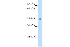 ABHD5 antibody used at 5 ug/ml to detect target protein. (ABHD5 Antikörper  (N-Term))