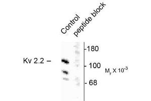 Image no. 1 for anti-Potassium Voltage-Gated Channel, Shab-Related Subfamily, Member 2 (KCNB2) antibody (ABIN372705) (Kv2.2 Antikörper)