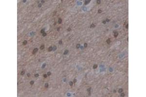 IHC-P analysis of Human Tissue, with DAB staining. (ZFHX4 Antikörper  (AA 1-189))